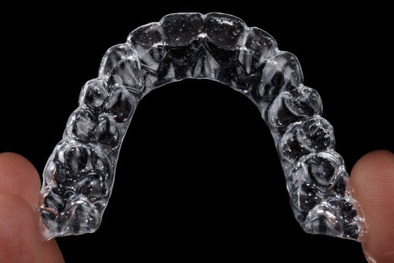 aligner 7169868 960 720