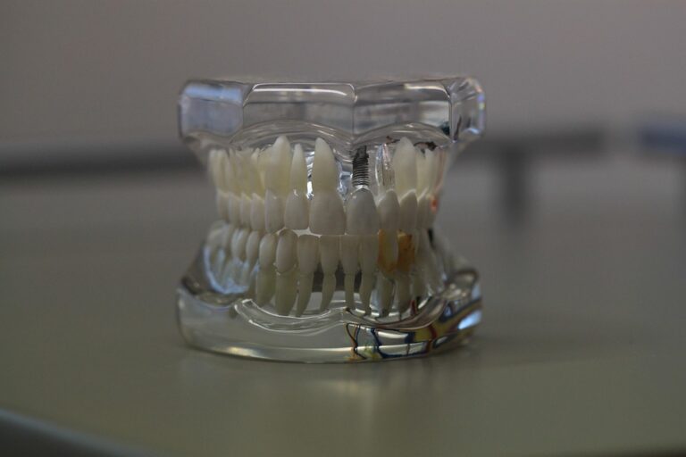 dentistry 668214 960 720