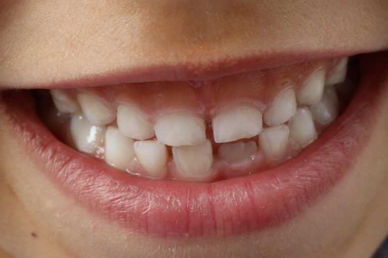 teeth 1743981 960 720