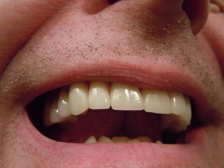 teeth 414489 960 720
