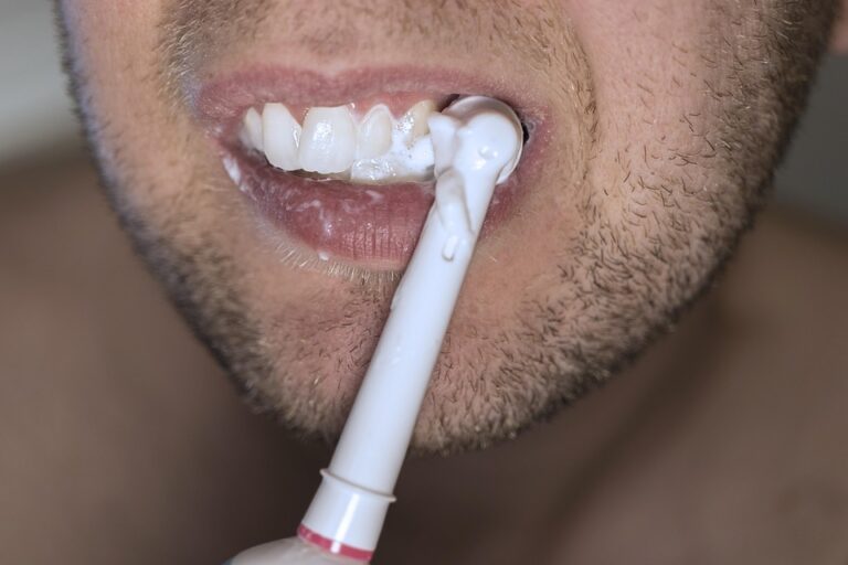 teeth 4620915 960 720