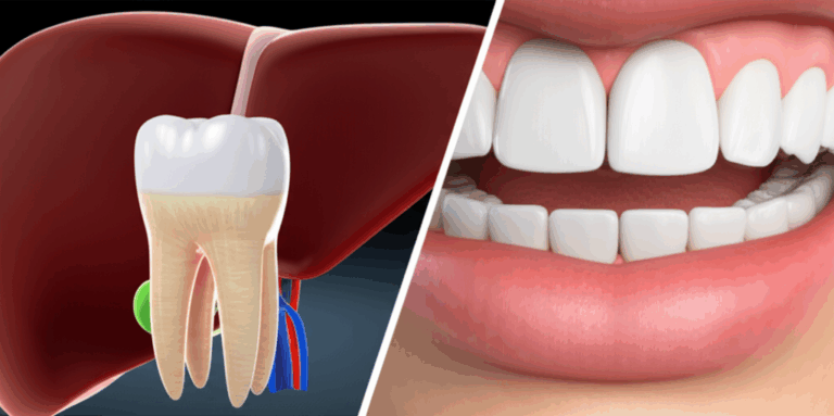 The Surprising Link Can Poor Oral Health Lead to Liver Problems Understanding the Connection